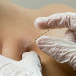Physical Therapy Wheaton Naperville